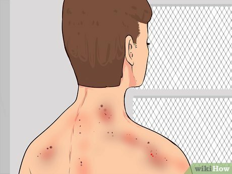 EFECTOS BIOLÓGICOS DE LA RADIACIÓN