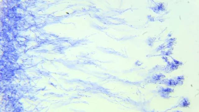 Sir Alexander Fleming