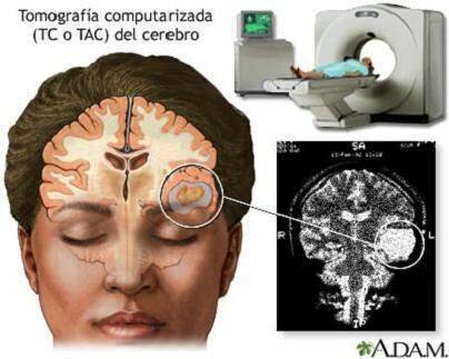 Los rayos X