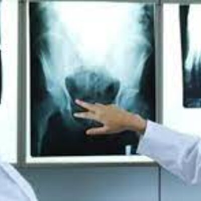 Timeline: LINEA DE TIEMPO RADIOLOGÍA CONVENCIOANAL