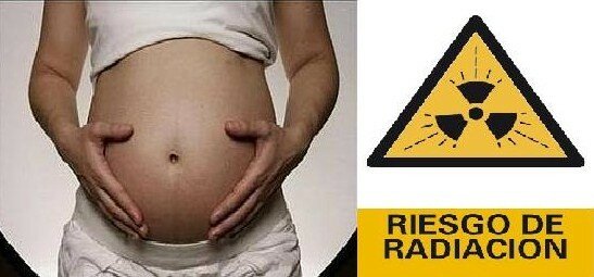 Comité internacional de protección radiológica