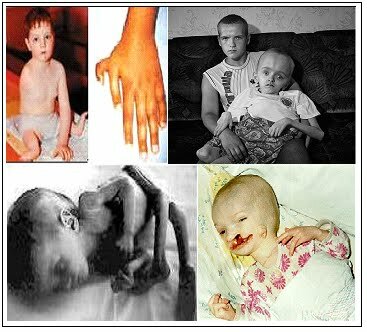 Efectos biológicos de la radiación