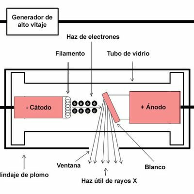 Como Funciona Un Tubo De Rayos X