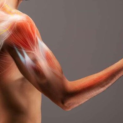 Timeline: Lesiones en el musculo en deportistas