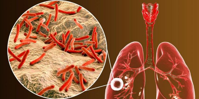 LA TEORÍA MICROBIANA