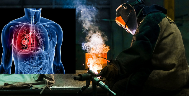 Se determina riesgo de cancer