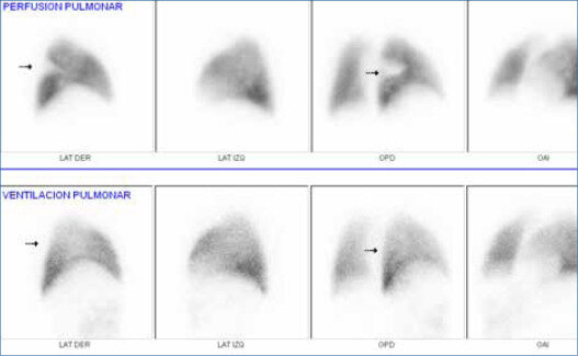 Primeras aplicaciones medicas de la radiacion