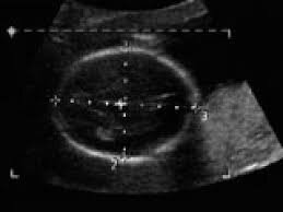 ultrasonido en escalas de grises por George Kosoff.
