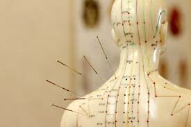 Acupuntura