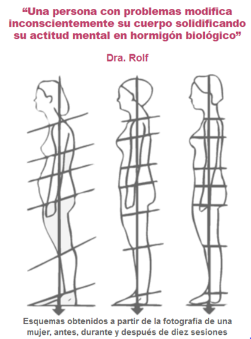 Terapias de movimiento (integración estructural de Rolfing)