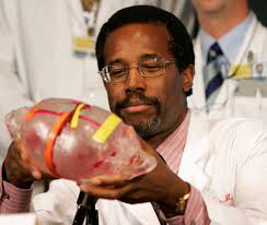 Ben Carson