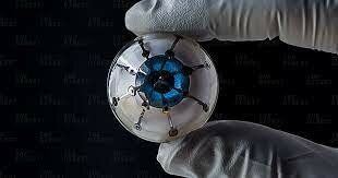 The Bionic Eye