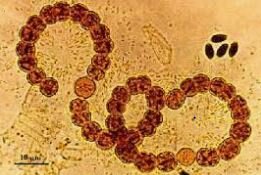 LA TEORÍA MICROBIANA DE LA ENFERMEDAD