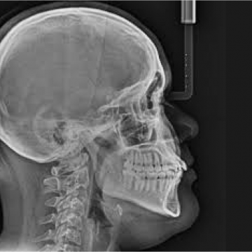 Base de la radiología