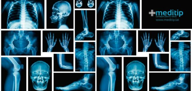 Rayos X del sistema ósea
