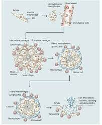 Primer Gen Clonado, expresado en una Bacteria Foranea.