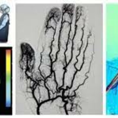 Timeline: Historia Angiografìa