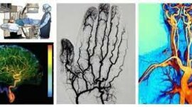 Timeline: Historia Angiografìa