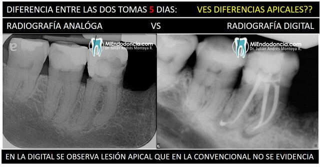 Reemplazo de la radiología convencional a radiología digital o computalizada