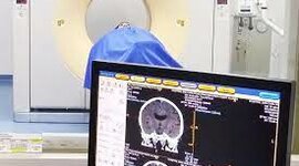 Timeline: Tomografía Computarizada