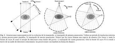Cambios en los Tomografos