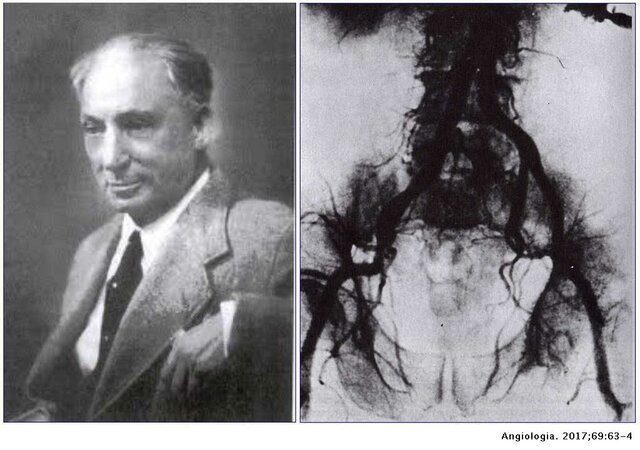 La Artrografía en muchas enfermedades médicas y quirúrgicas.