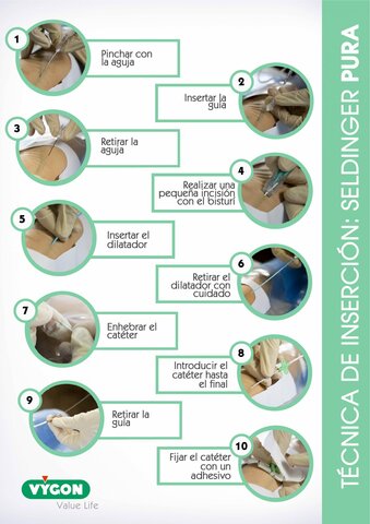 Técnica de Seldinger