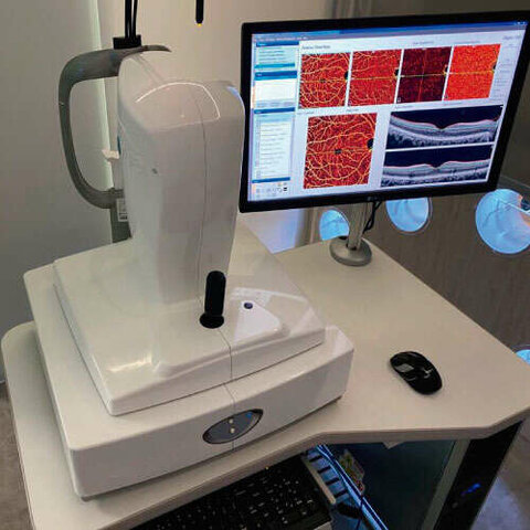 Aparición de la Angiografía Digital