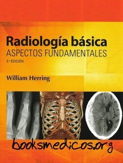 Editaron Atlas de Radiología Ósea