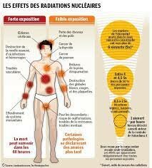 Efectos agudos de la radiación