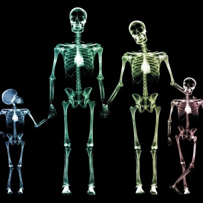 Timeline: Historia radiológica