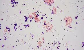 AUG 5, 1884 TINCION DE GRAM