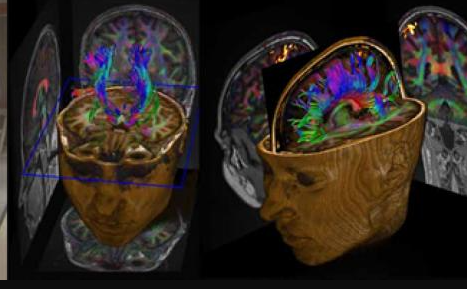 los trabajos Richard Ernst y Kurt Wüthrich en el desarrollo de secuencias de pulsos diseñadas para obtener espectros en dos dimensiones (2D-RMN)