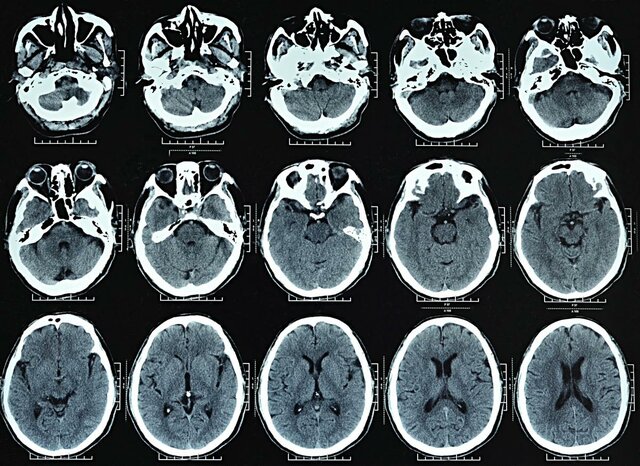 Evento 6-Los rayos x