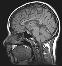 Evento 7-Los rayos x