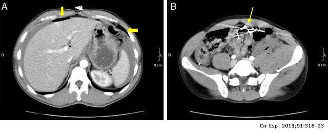 Nació la tomografía multidectector