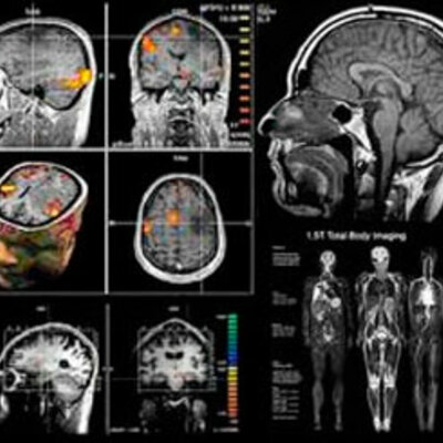 Timeline: Resonancia Magnética Nuclear _James Paladines_154006