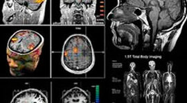 Timeline: Resonancia Magnética Nuclear _James Paladines_154006