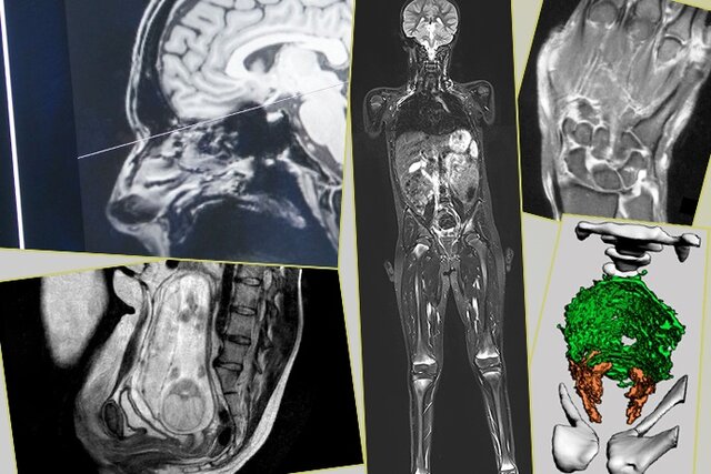 La radiología moderna en sus inicios.