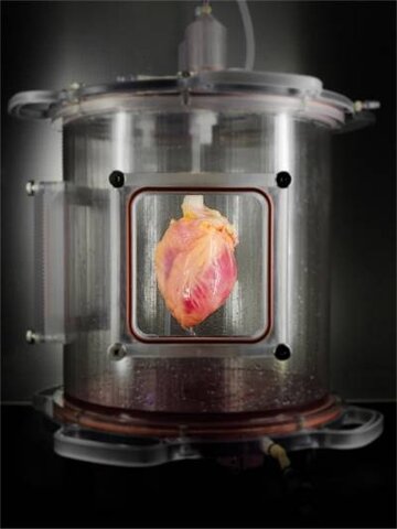 Células cardiacas
