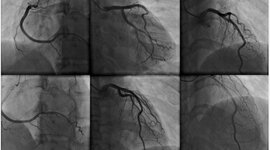 Timeline: ANGIOGRAFIA