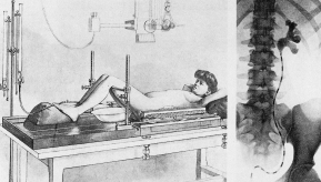 Aplicaciones desde 1895 hasta nuestros días de la radiación ionizante