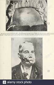 Efectos perjudiciales para la salud