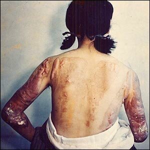 Efectos biológicos de la radiación