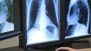 rayos emitidos por el uranio