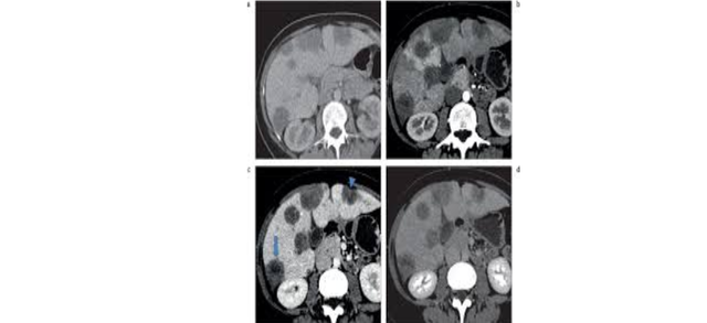 MULTIDETECTOR - RM ULTRARRAPIDAS