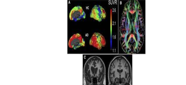 IMAGEN FUNCIONAL Y MOLECULAR