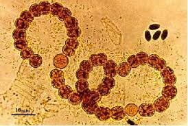 La teoría microbiana sin Pasteur y koch