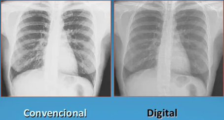 Radiología digital