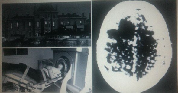 Hospital Atkinson Morley